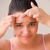 TopVerySimpleTipstoavoidPimples