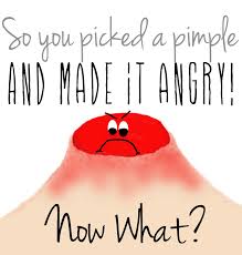 TopVerySimpleTipstoavoidPimples