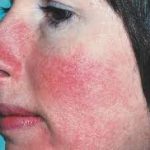 TopNegativeEffectsofUsingCosmeticsandMakeupDaily
