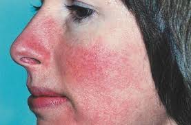 TopNegativeEffectsofUsingCosmeticsandMakeupDaily
