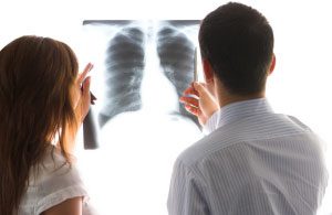 TopMostCommonCancerTypes