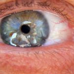TopCommonEyeProblems