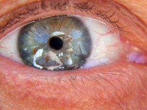 TopCommonEyeProblems