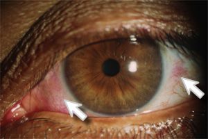 TopCommonEyeProblems