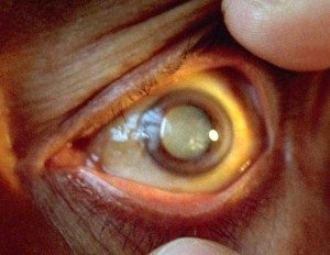 TopCommonEyeProblems