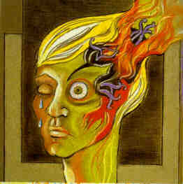 Migraines