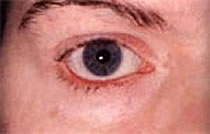 TopCommonEyeProblems