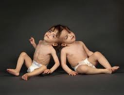 TopDifferentTypesofTwins