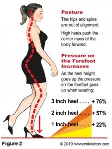 TopTipstoImproveBodyPosture